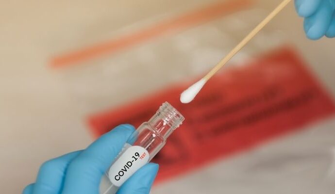 antigen test 2610211 Адреси на лабораториите в Ловеч издаващи  сертификат с 48-часова валидност по метода бърз антигенен тест за COVID-19 без заплащане стойността на теста от страна на гражданите