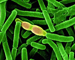 bacillus anthracis 260826 Огнище на антракс е установено в животновъден обект в село Стефаново