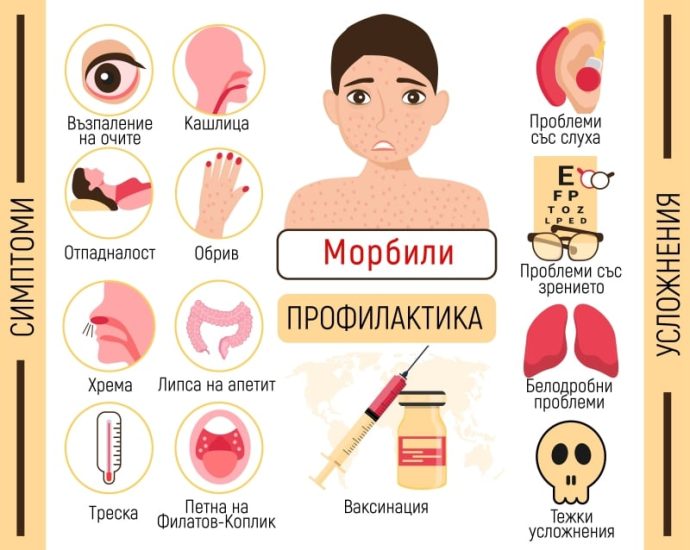 morbili simptomi uslojnenia profilakika 30826 Осем случая на морбили са регистрирани в Угърчин за една седмица
